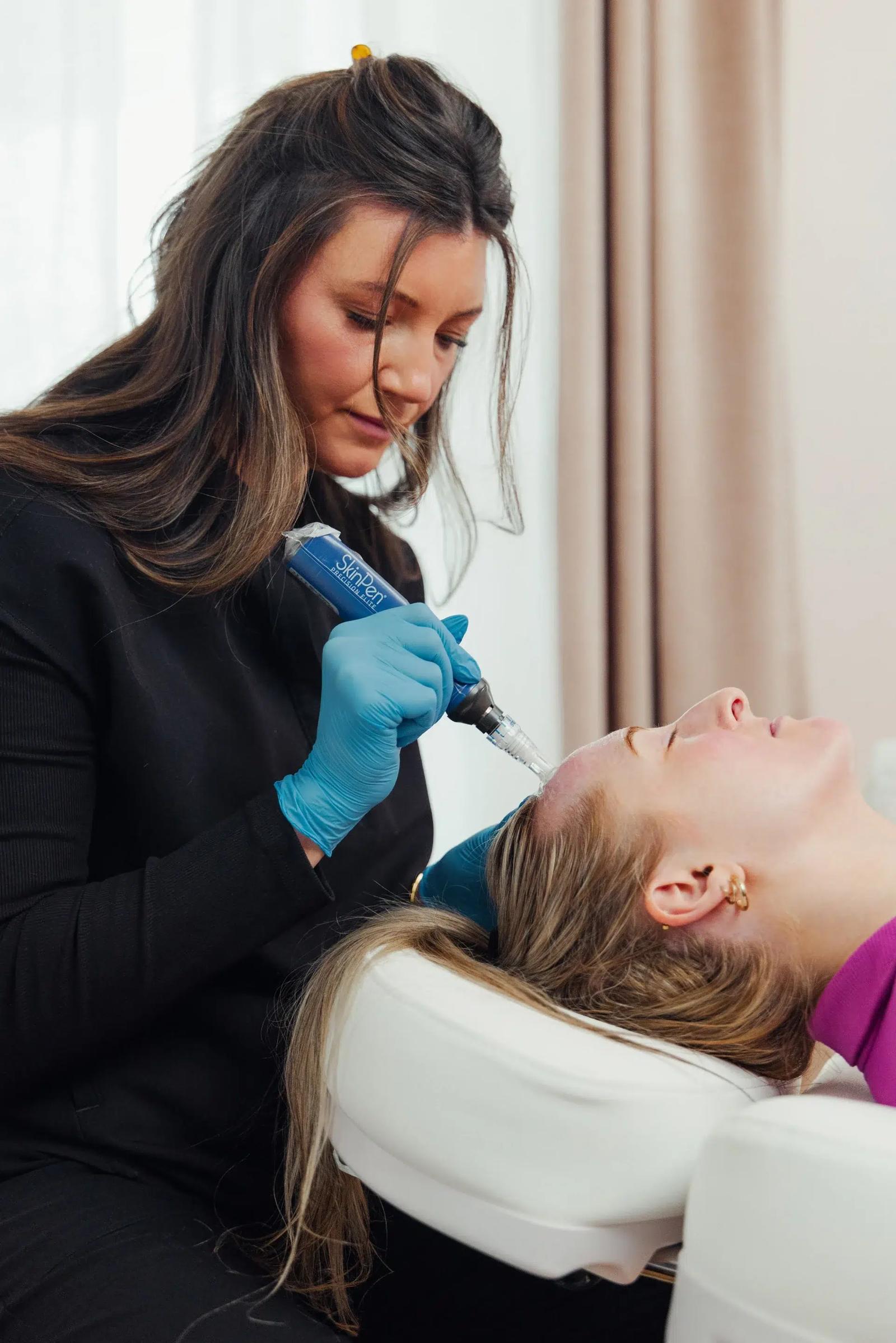 Practitioner in blue gloves performing a SkinPen microneedling treatment on a female patient's hairline.